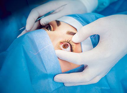 squint eye surgery