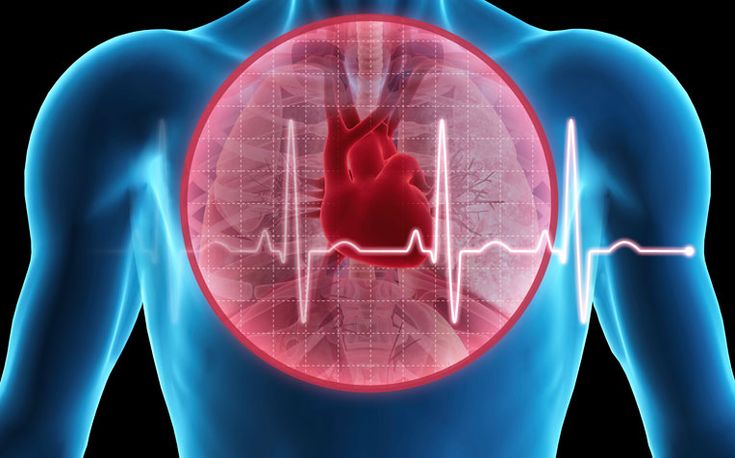 heart bypass surgery