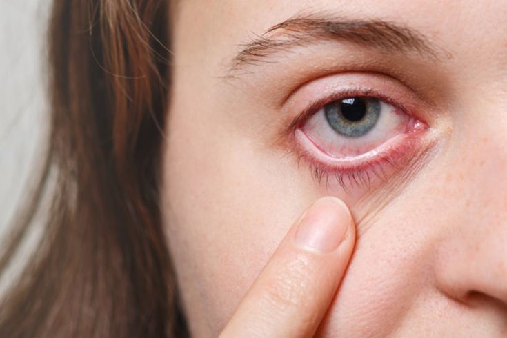 retinal detachment surgery