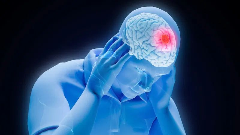 brain stroke treatment