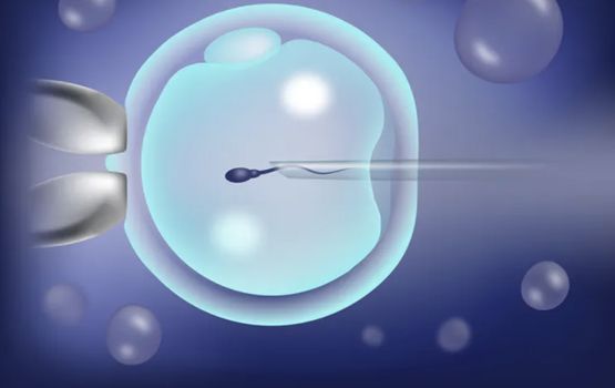laser assisted hatching treatment