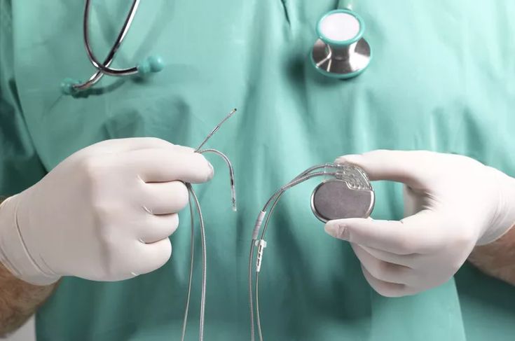 pacemaker implant surgery