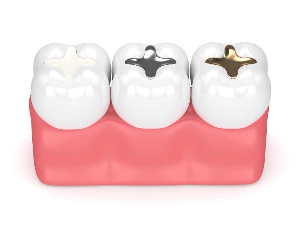 dental crown and bridge treatment